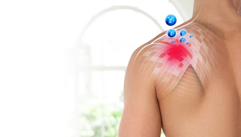 Over-the-Counter Pain Gels and Sprays Where They Help and Their Limitations