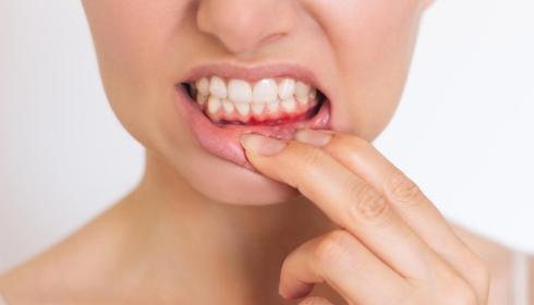 Receding Gums Early Warning Signs You Shouldn’t Ignore in the Mirror