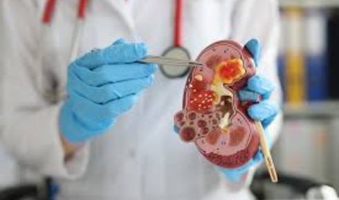 Urologist Specialist In Bangalore